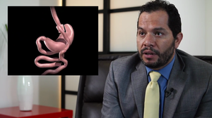 dr_garcia_small_bariatric