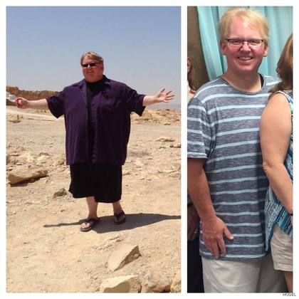 Gastric Sleeve - Click to View Cases<br>29 Cases